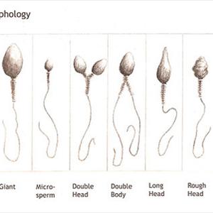 Calendar For Fertility Days - Manage Stress Of Infertility