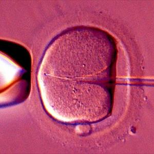 Calendar Com Ovulation - Different Ways To Get Unexplained Infertility Success